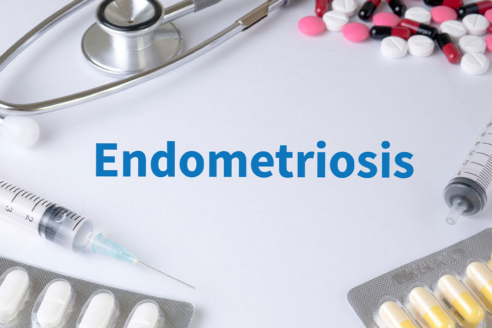 Endometriosis – Symptoms and natural remedies